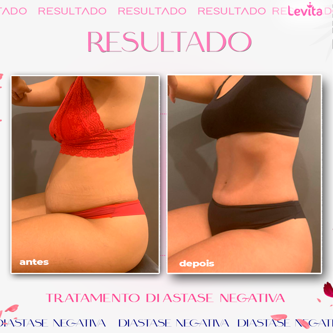 Resultado Diastase Negativa