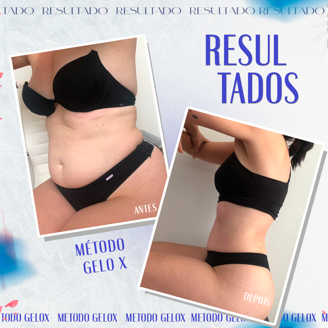 RESULTADOS