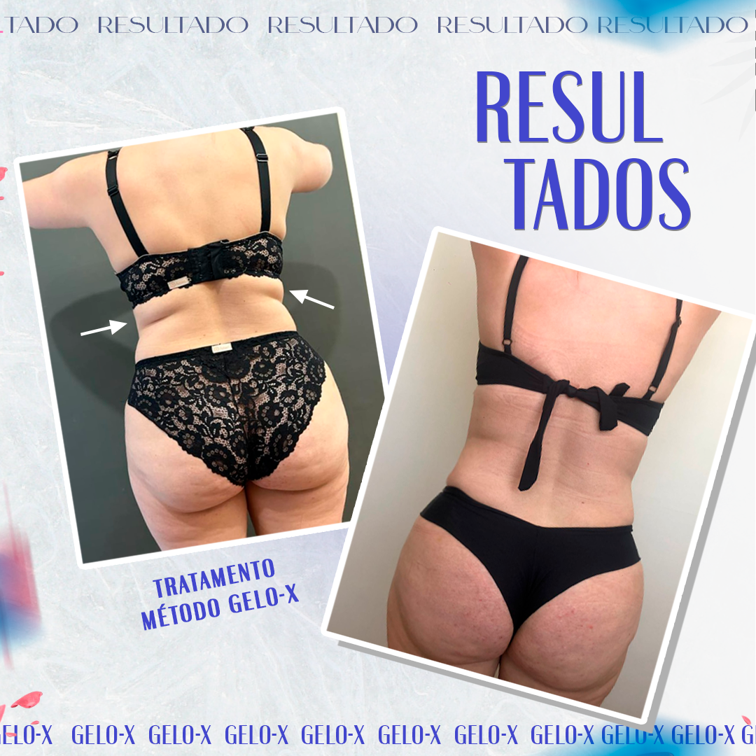 RESULTADO