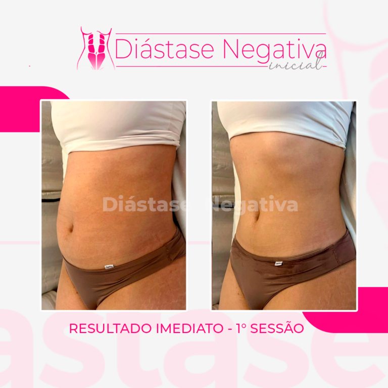 ANTES-DEPOIS-2026-2 (1)