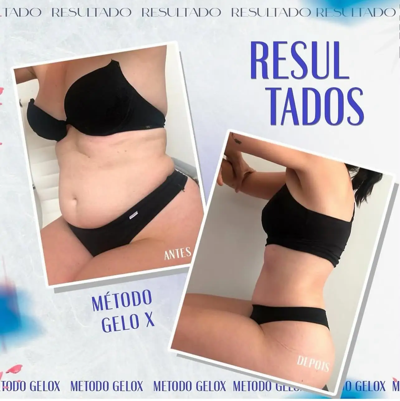 Resultado Método Gelo-X 1