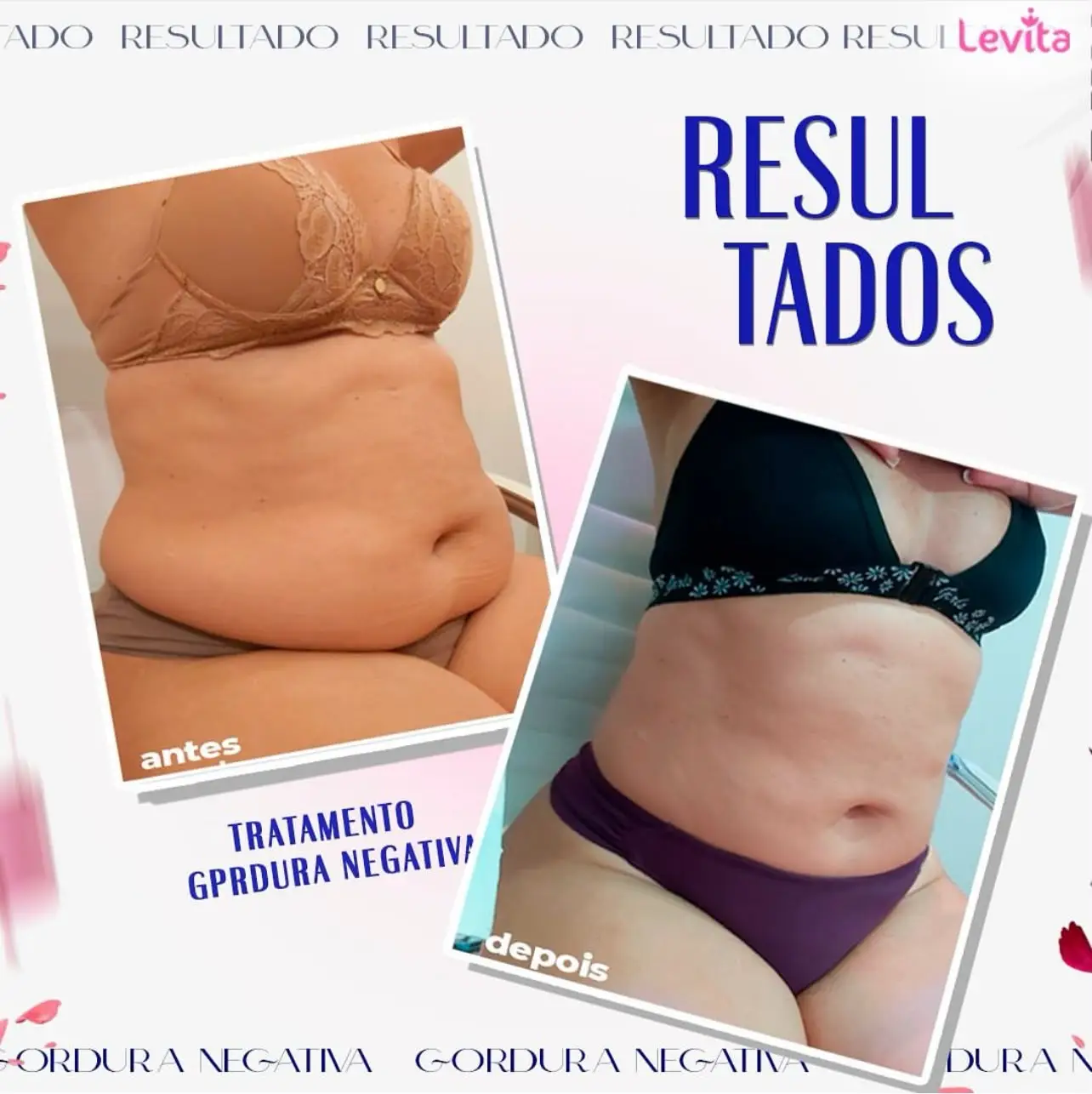 Resultado Método Gelo-X 7