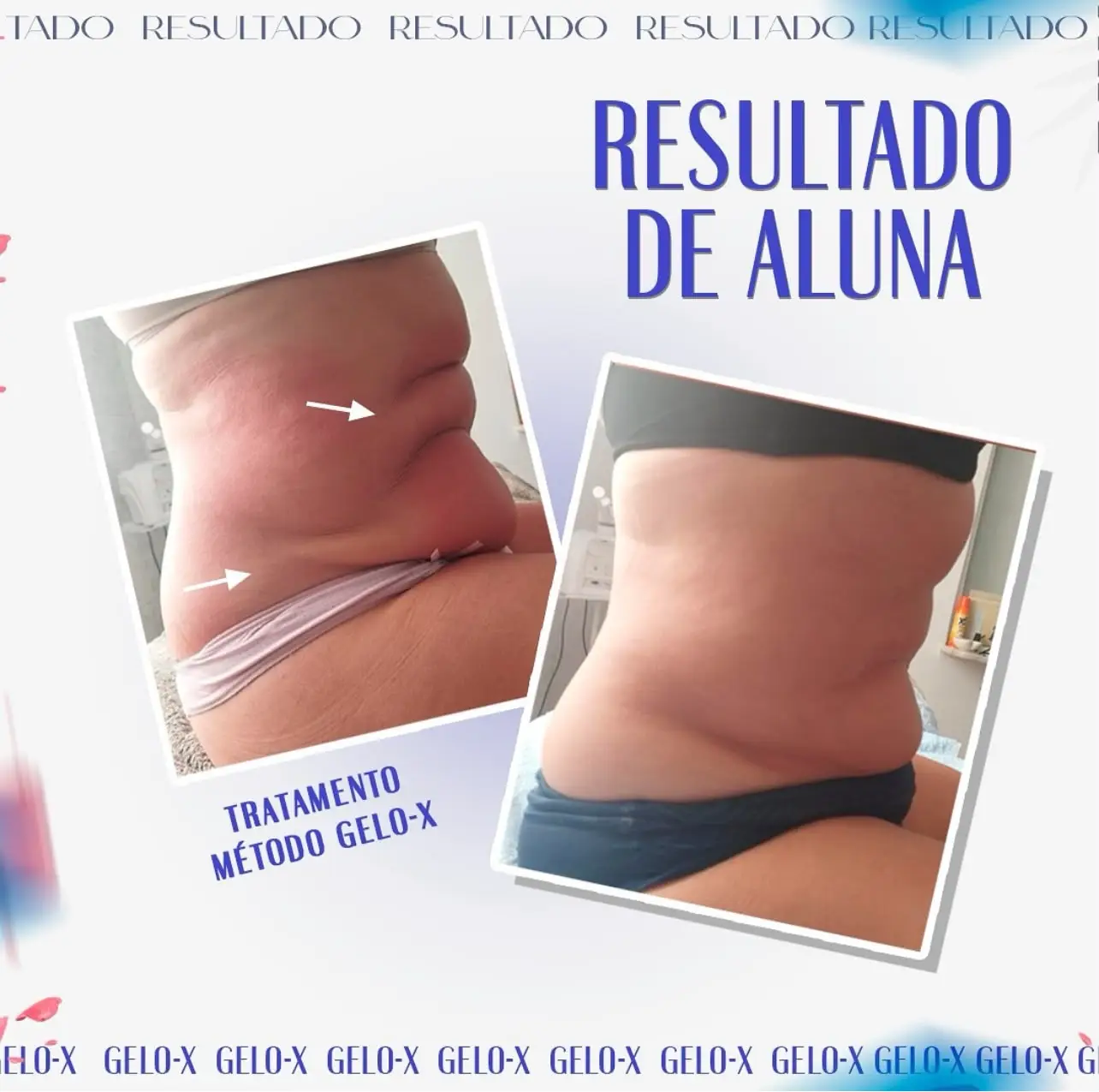 Resultado Método Gelo-X 2